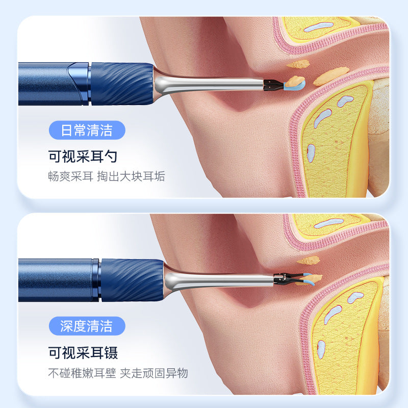 Ear picking endoscope HD ear scoop