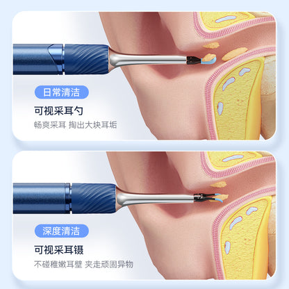 Ear picking endoscope HD ear scoop